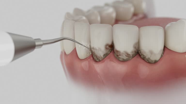 Trusted Teeth Cleaning And Checkup service in Fort Worth, TX - Dentist Open Now